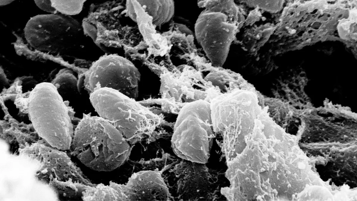 Microscopia da bactéria Yersinia pestis associada a investigações de saúde na Rússia.