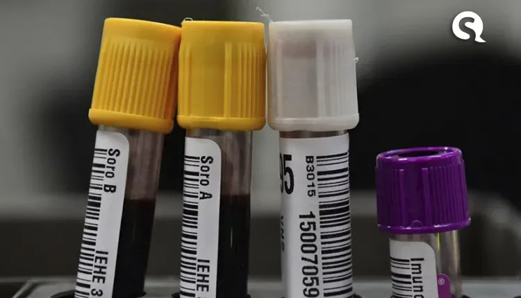 Tipo sanguíneo e genes podem ter ligação com gravidade da Covid-19