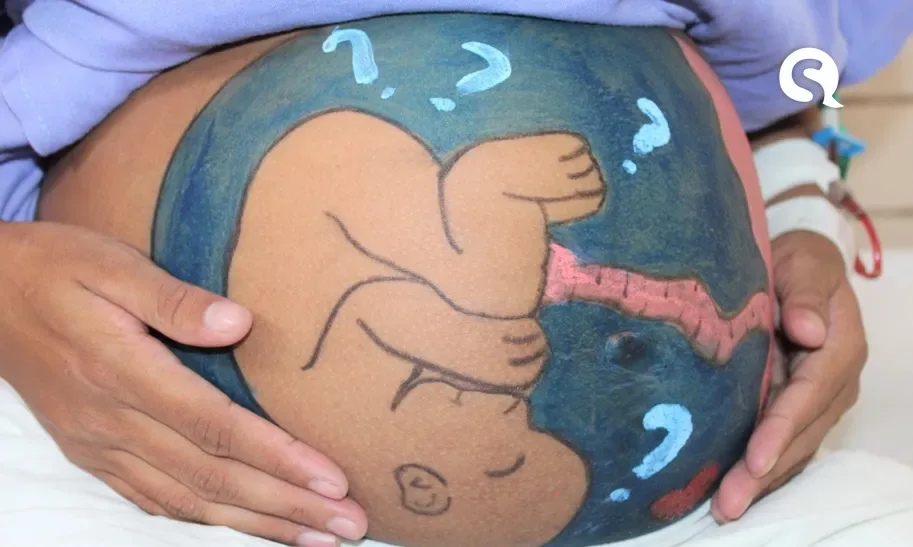 Pintura em barriga encanta gestantes na Maternidade da Santa Casa de Sobral