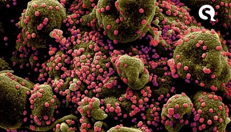 virus