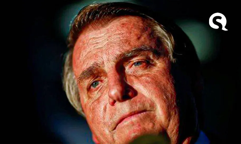 Bolsonaro está com obstrução intestinal e será transferido para São Paulo