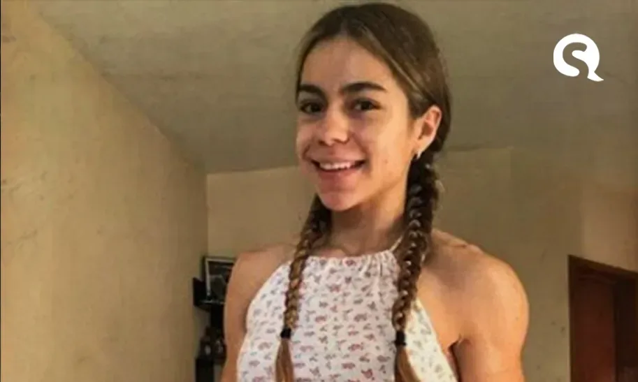 Influenciadora fitness morre após cirurgia para reduzir suor