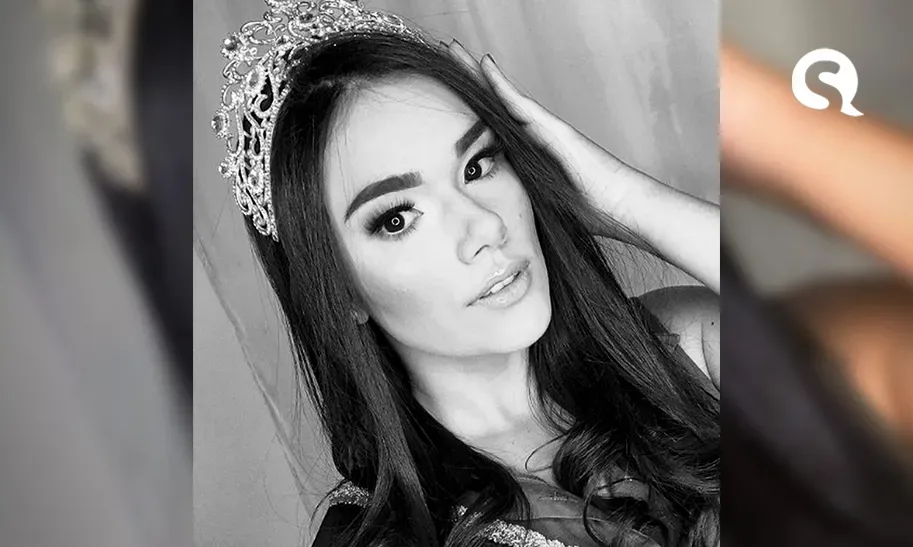 Miss Roraima Teen morre aos 21 anos durante cirurgia de emergência após passar mal