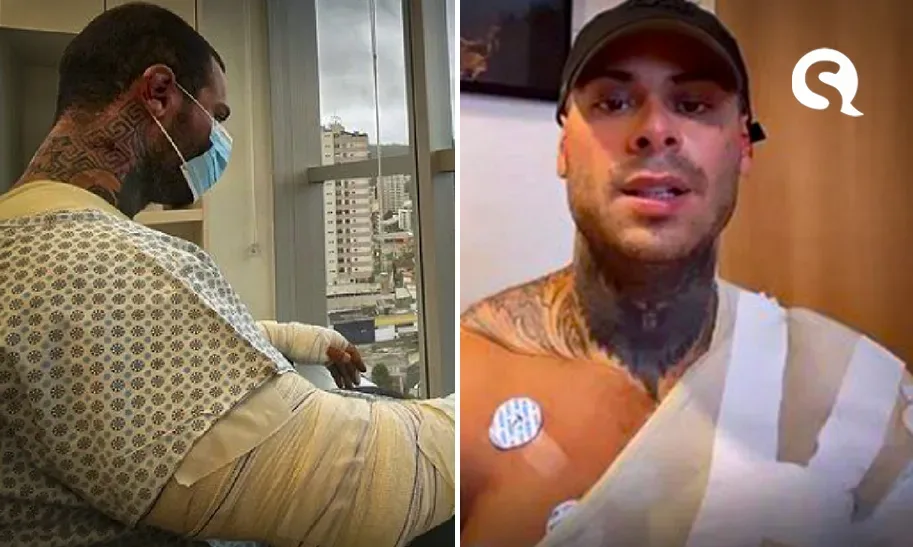 Leo Stronda tem 30% do corpo queimado e passa por cirurgias após acidente doméstico