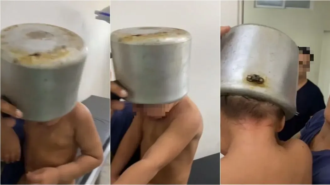 Criança prende a cabeça em panela de pressão em Granja