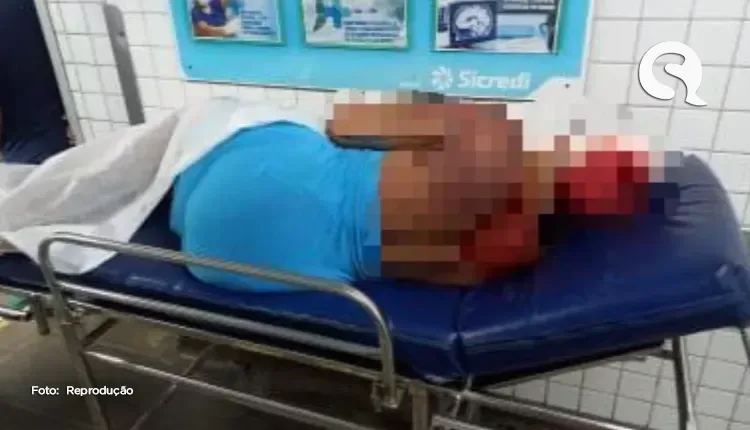 Travesti é espancada por homens dentro de motel em Fortaleza