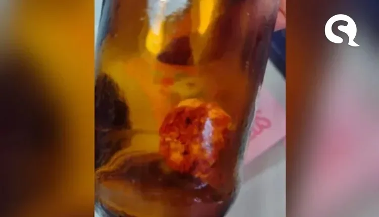 Marceneiro encontra dedo dentro de garrafa de cerveja