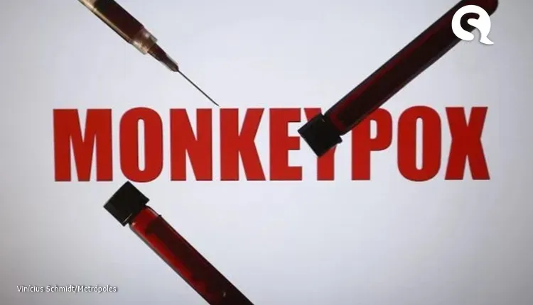 Homens de 18 a 49 anos são maioria com monkeypox no Brasil
