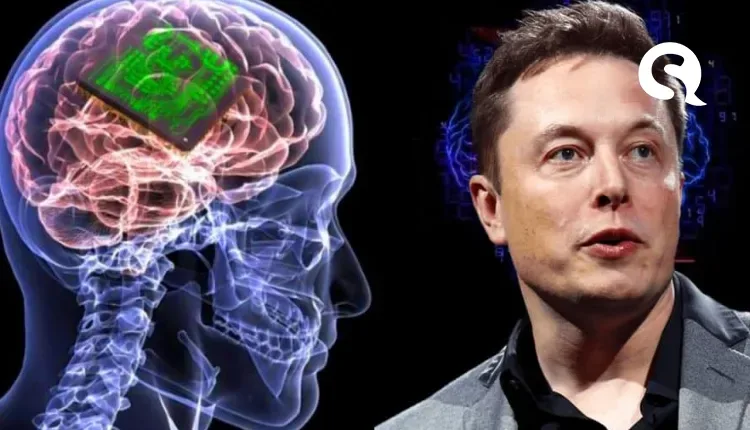 Elon Musk quer implantar chips cerebrais em humanos dentro de seis meses