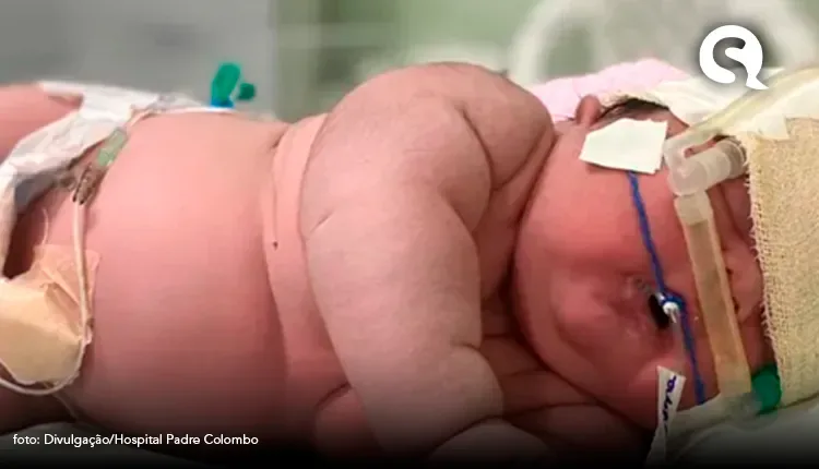 Recém-nascido de 7 kg quebra recorde e passa a ser o maior bebê do Amazonas
