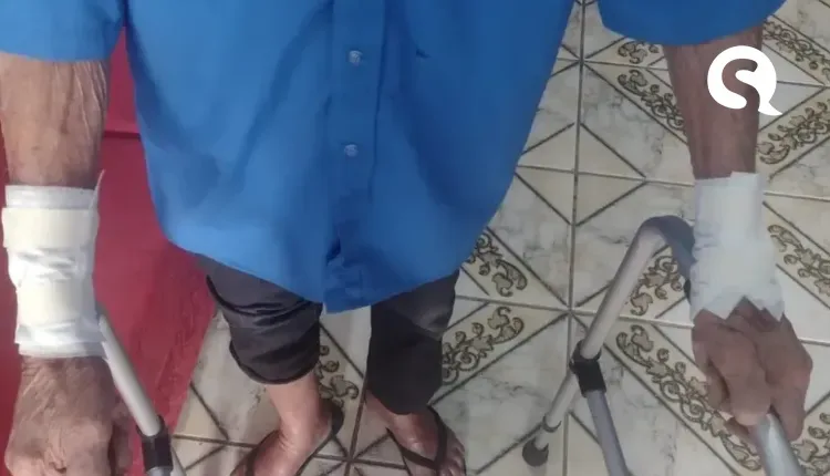 Idoso é agredido e tem os braços cortados pelo filho no interior do Ceará