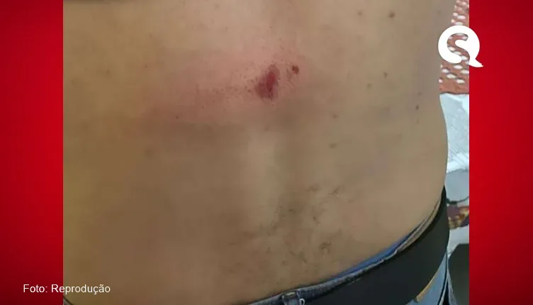 Vereador leva lapada no espinhaço em brincadeira de quebra-pote
