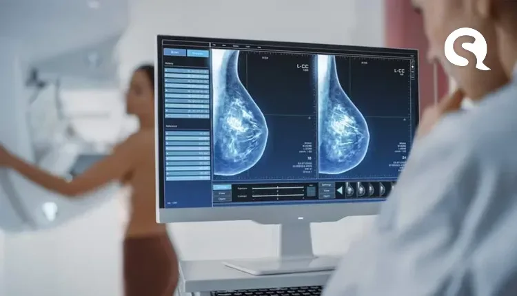 Exames de mamografia serão ampliados em 29% na policlínica de Sobral e em outras unidades durante outubro