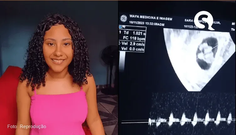 Jovem de 18 anos descobre gravidez de cinco bebês e passa mal no meio da ultrassom