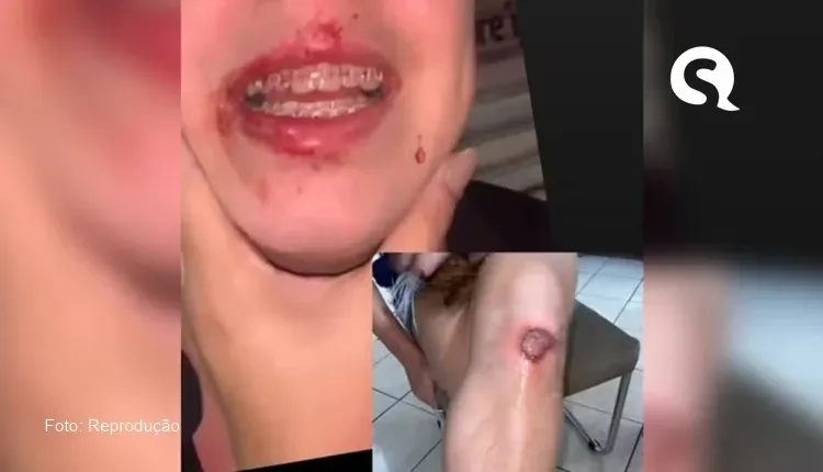 Policial é preso por agredir DJ que defendia amiga de assédio em festa de carnaval em São Benedito