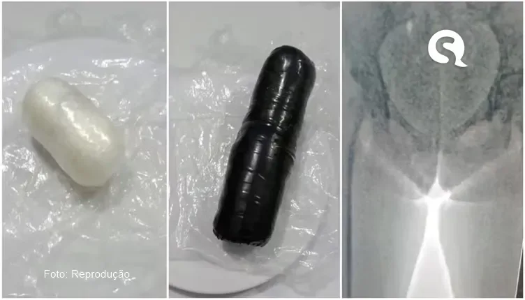Mulheres são presas são ao tentar entrar em presídio no Ceará com drogas nos órgãos genitais