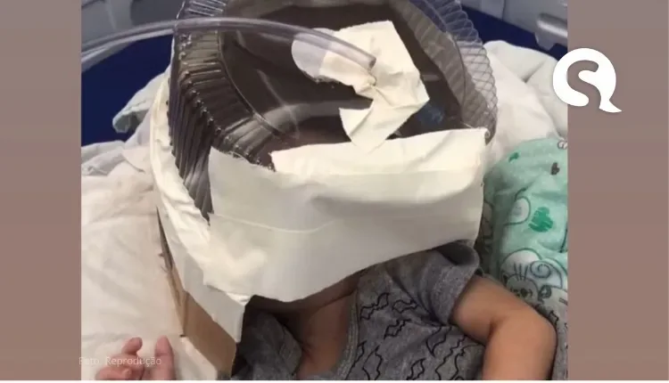 Hospital usa embalagem de bolo como máscara de oxigênio em bebê