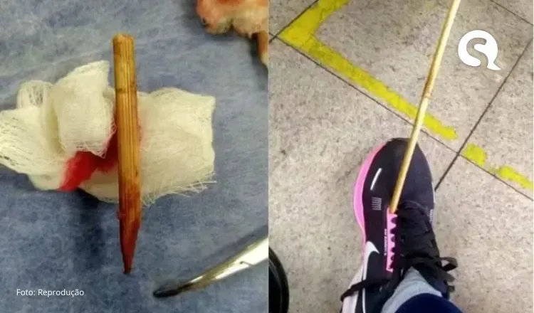 Mulher é atingida por “flecha” enquanto caminhava pela rua
