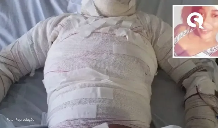 Homem ateia fogo e queima corpo de ex-mulher no interior do Ceará; filha da vítima também sofreu queimaduras