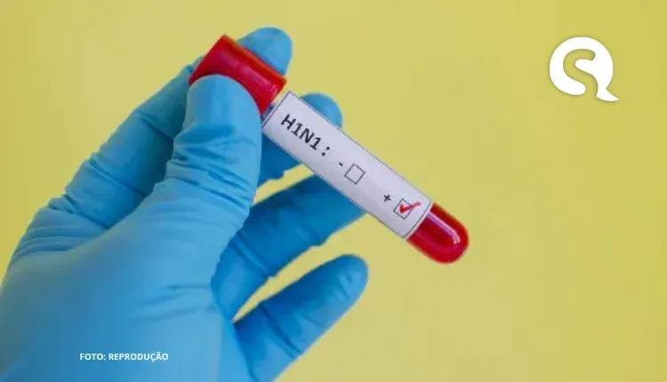 O que é H1N1 e como evolui para broncopneumonia, causa da morte de Silvio Santos?