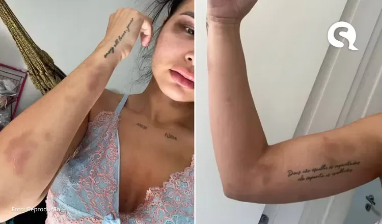 Modelo cearense denuncia agressão do ex-companheiro e tem lesões na cabeça, pescoço, olho e tórax