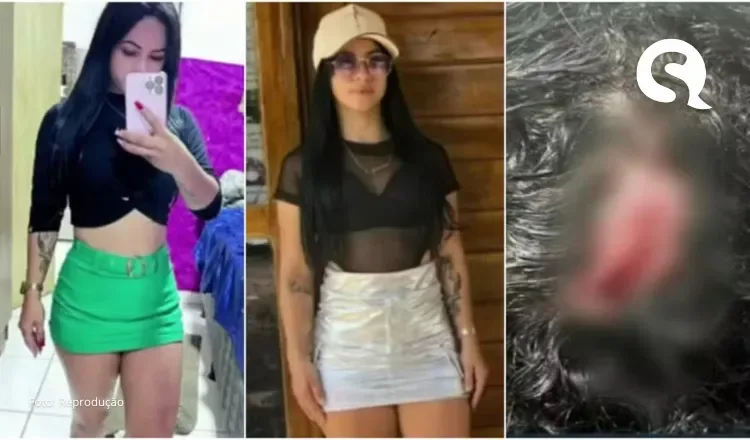 Influenciadora é agredida com taco de sinuca no Ceará; ex-marido é suspeito do crime