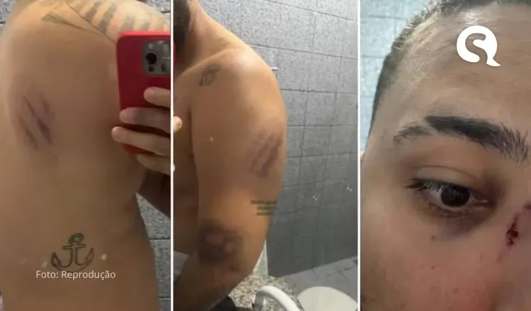 Influenciadora e professor denunciam agressões de policiais em festa de Carnaval em Aracati, no Ceará