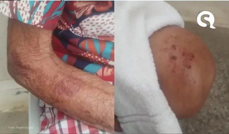 Idosa de 84 anos é hospitalizada após ser agredida pelo marido no interior do Ceará