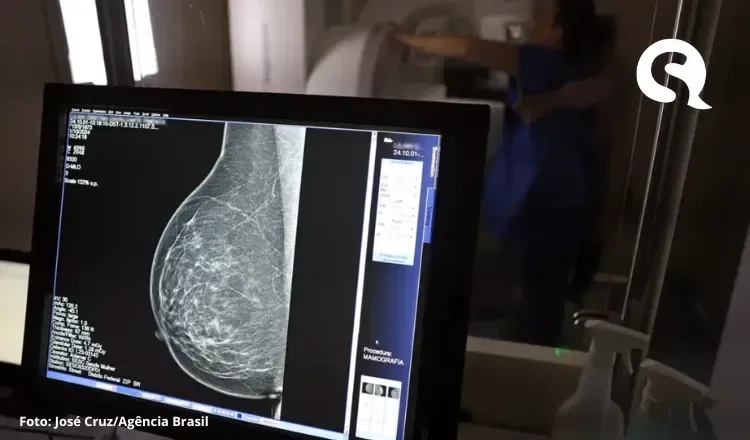 Faixa etária da mamografia é ampliada no SUS; exame passa a ser indicado até os 74 anos