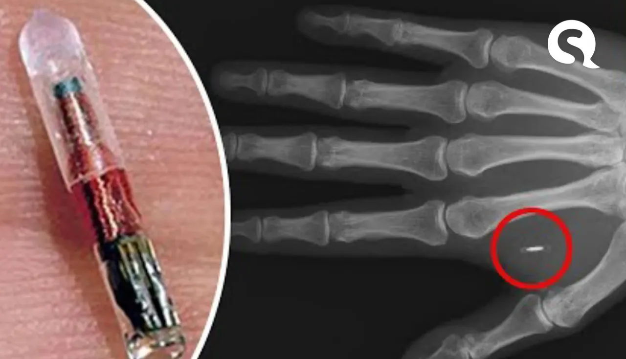 Microchips na pele: milhares de suecos substituem cartões e chaves por implantes