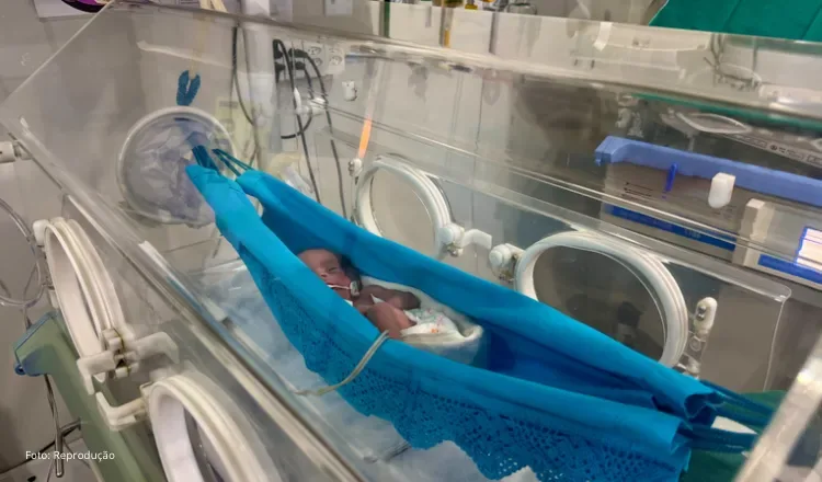 Redeterapia promove conforto e desenvolvimento de bebês prematuros na Santa Casa de Sobral